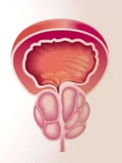 Entzündung der Prostata